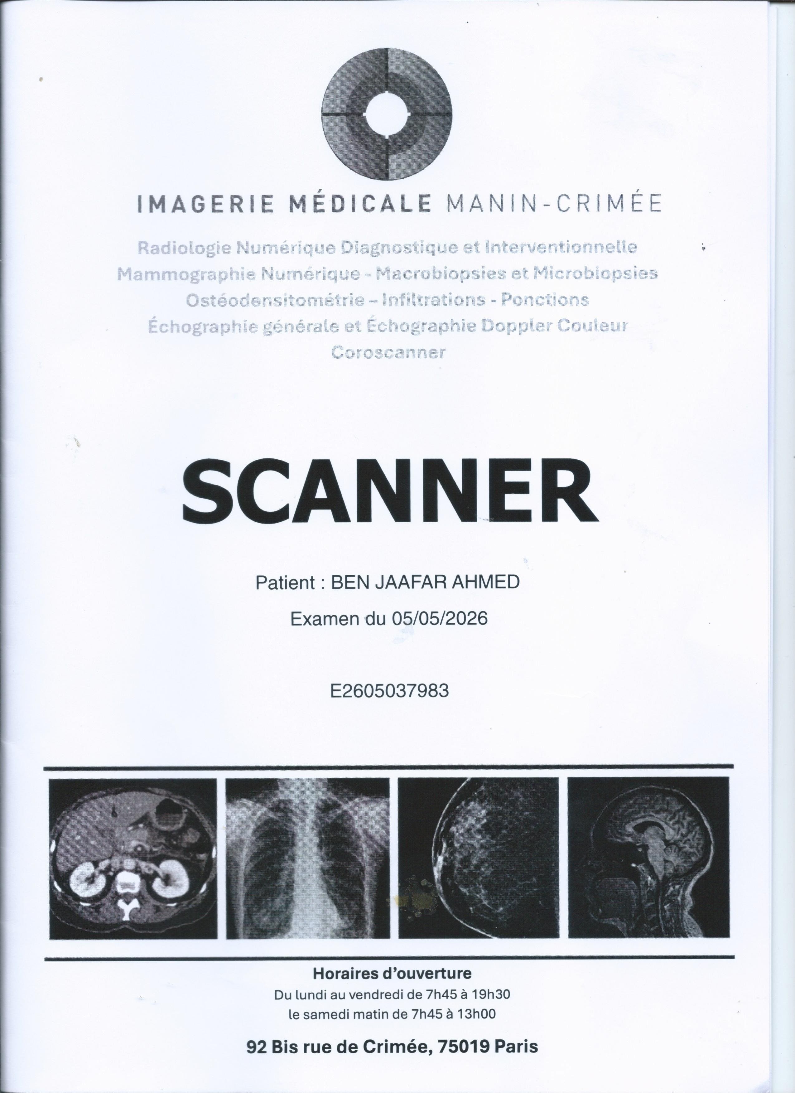 SCAN de la cheville droite