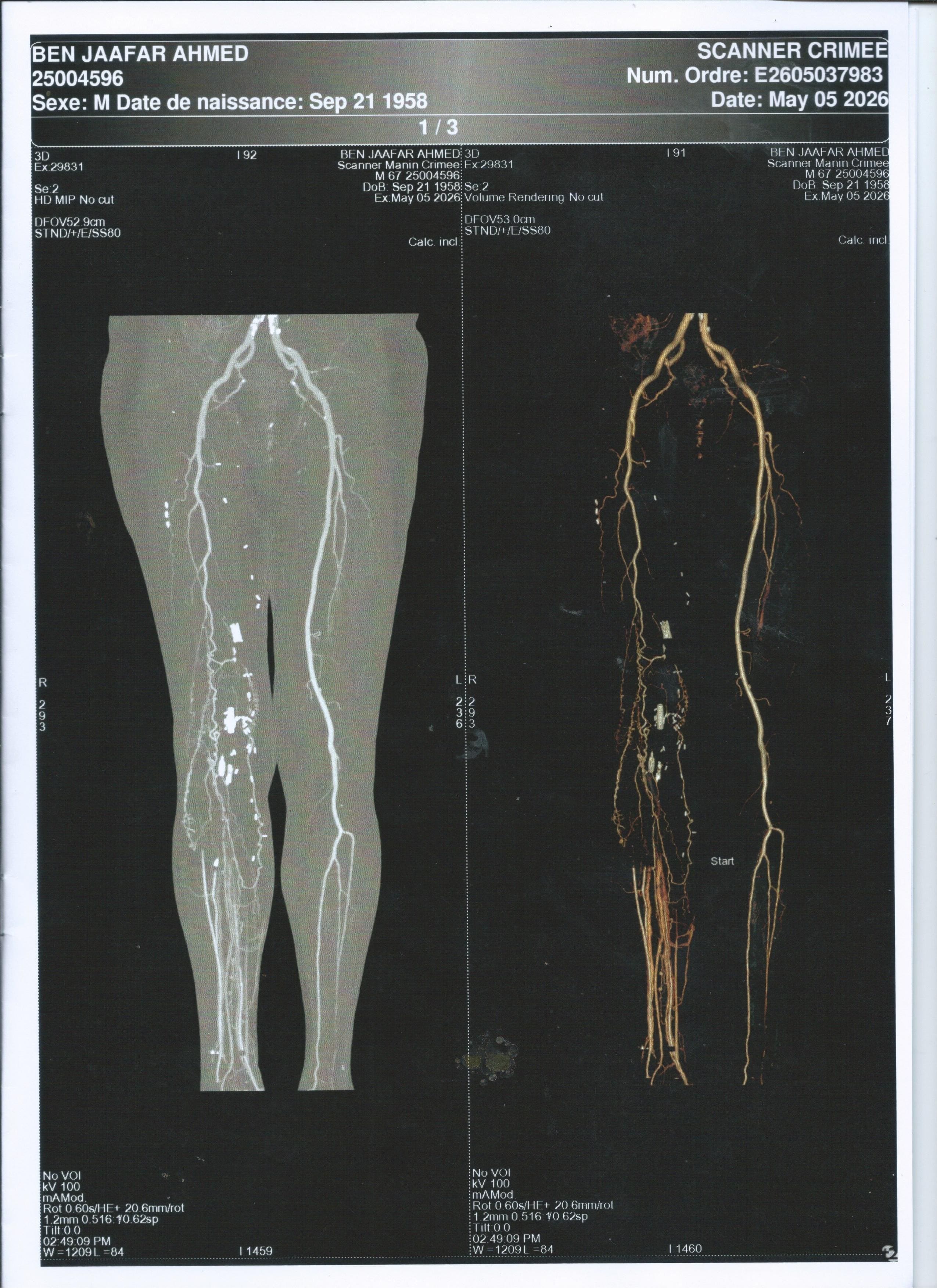 SCAN de la cheville droite